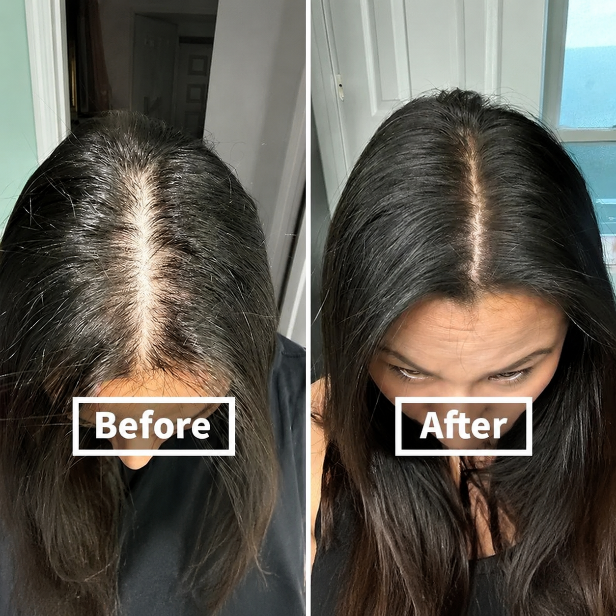 Rootiva before and after — visibly thicker, fuller part