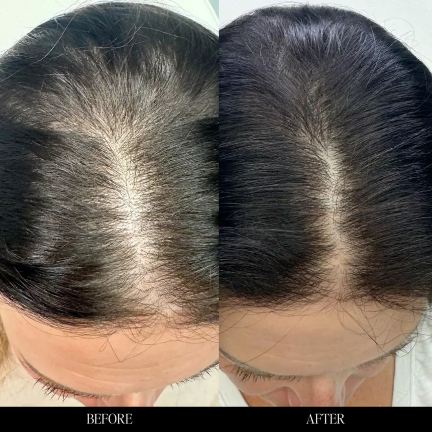 Rootiva before and after — 60 days of daily use